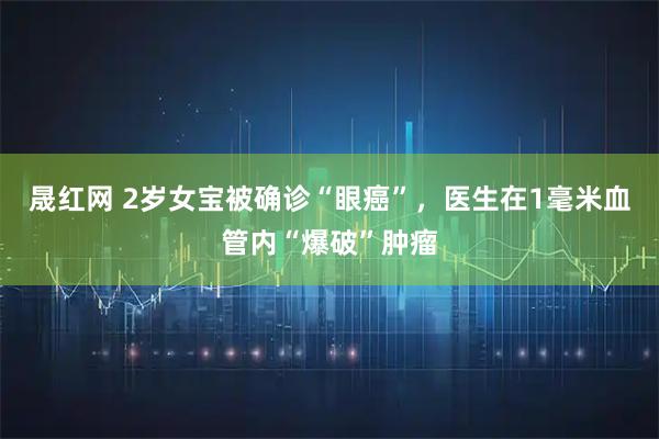 晟红网 2岁女宝被确诊“眼癌”，医生在1毫米血管内“爆破”肿瘤